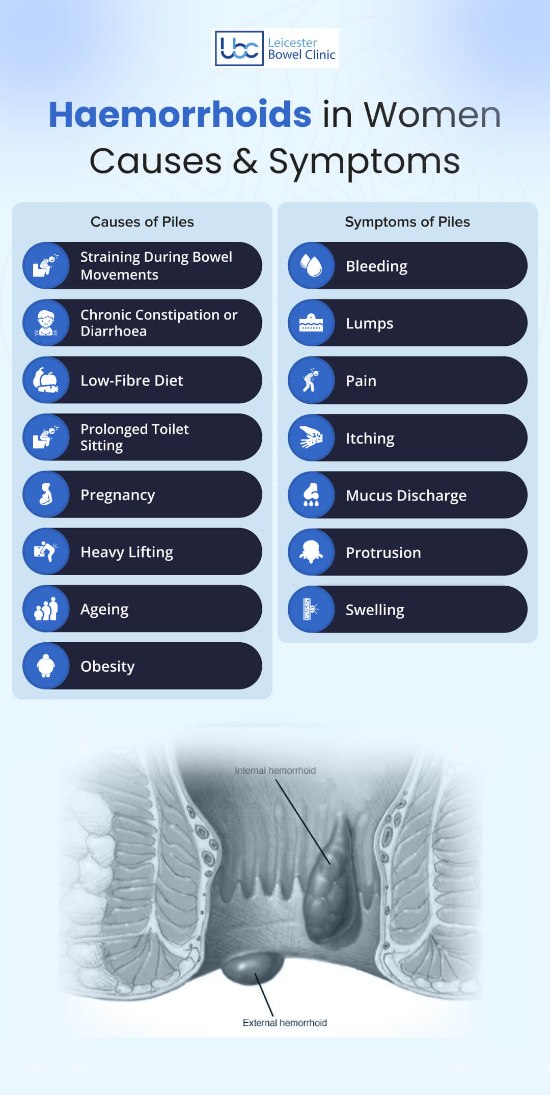 Haemorrhoids  Causes & Symptoms in Women